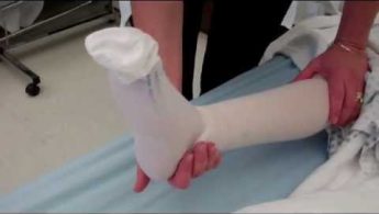 A medical professional holds a leg wrapped in a cast or bandage while standing next to a hospital bed.